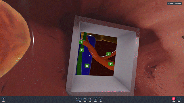 A 3D simulation shows an “escape room” through the GI tract. 